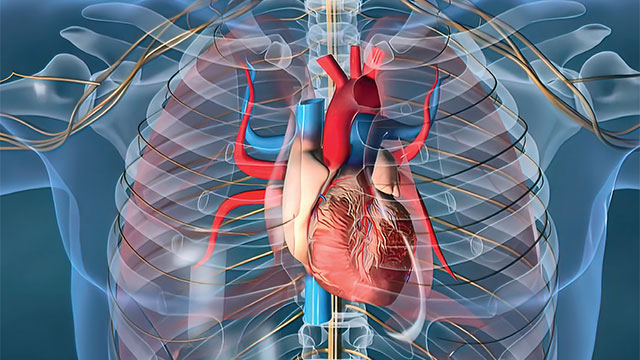 ROM Technologies / ROMTherapy